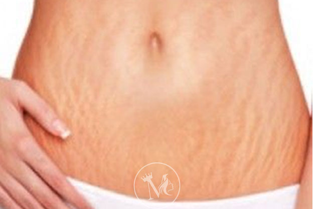Mumbai Permanent Makeup Studio